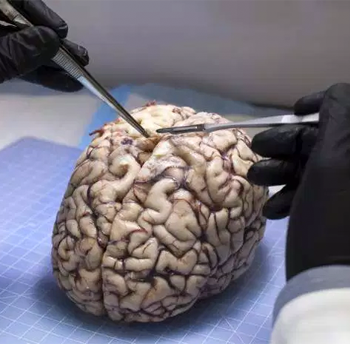 an image of a brain being dissected