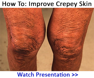 How To: Fix Crepey Skin - Watch Presentation